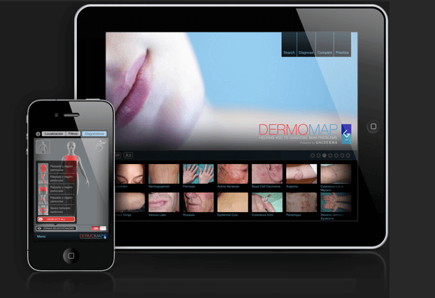 Aplicación dermatológica para IPAD e IPHONE: DERMOMAP