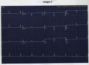 Preguntas CARDIOLOGÍA Y CIRUGÍA VASCULAR. MIR 2011 – 28 enero 2012