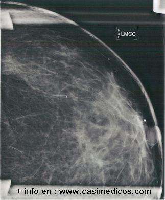 Preguntas Radiología MIR 2012 – 2 febrero 2013