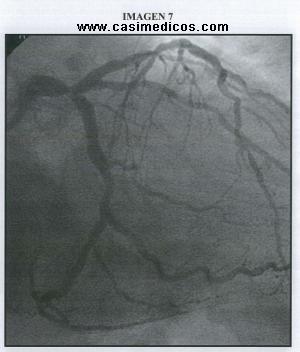 Preguntas Cardiologia MIR 2012 – 2 febrero 2013