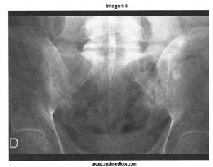 MIR 2013-2014: Preguntas de REUMATOLOGÍA