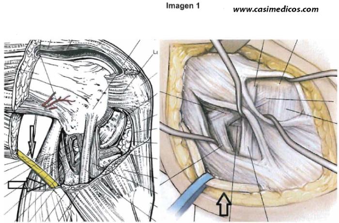 Respuestas ANATOMÍA examen MIR 2016