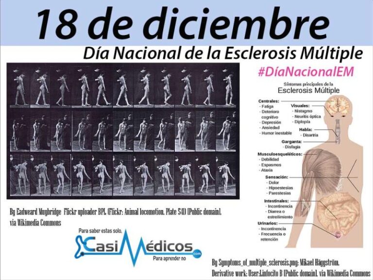 18 de Diciembre: Día Nacional de la Esclerosis Múltiple