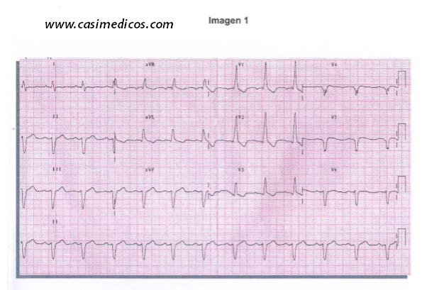 Respuestas Cardiología y cirugía Cardiovascular examen MIR 2018