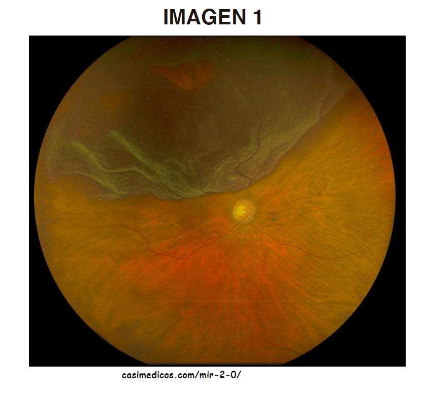 imagen1-MIR2021