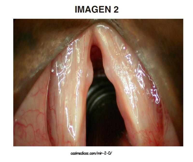 imagen2-MIR2021