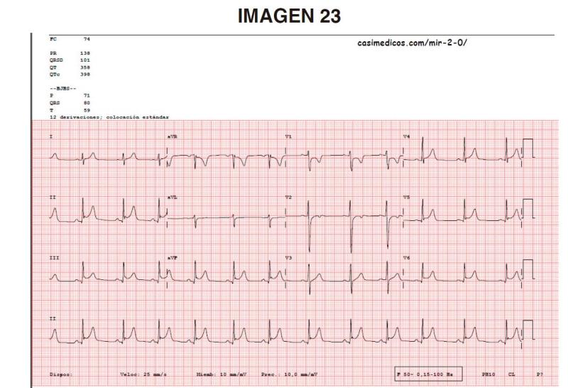 imagen23-MIR2021