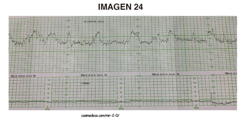 imagen24-MIR2021