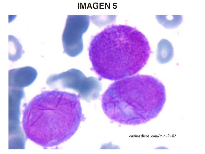 imagen5-MIR2021