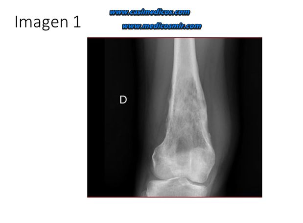 Imagen 1 del examen MIR 2026