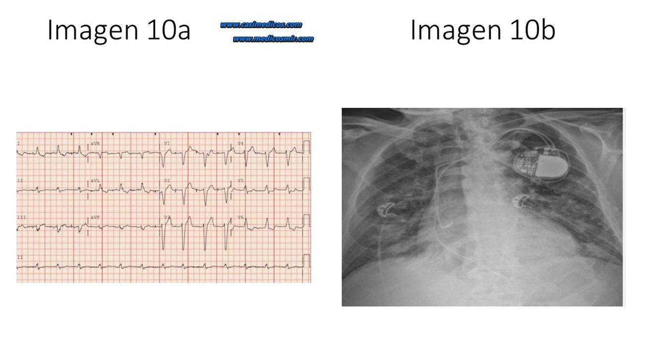 Imagen 10 del examen MIR 2026