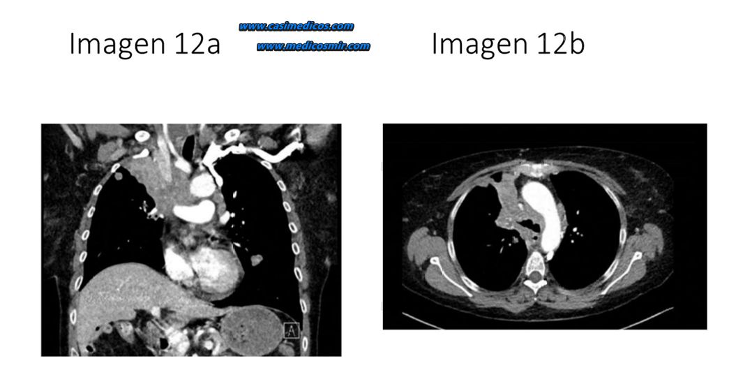 Imagen 12 del examen MIR 2026