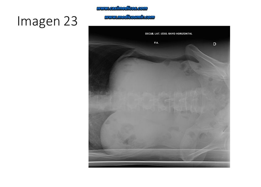 Imagen 23 del examen MIR 2026