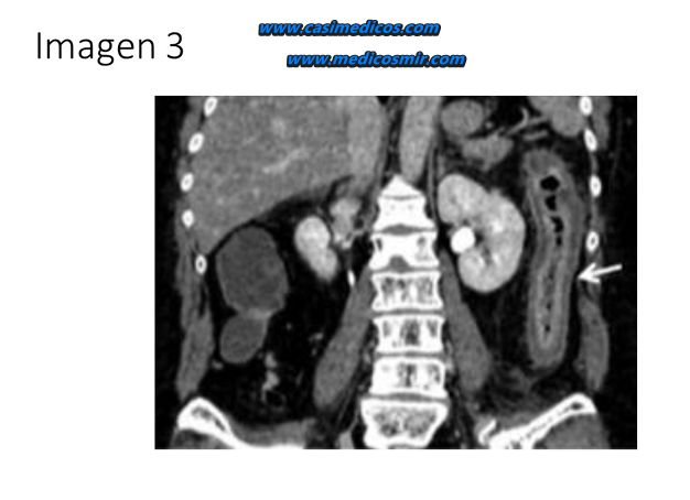 Imagen 3 del examen MIR 2026
