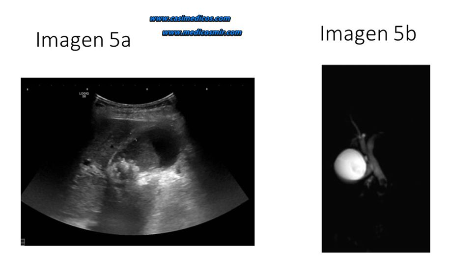 Imagen 5 del examen MIR 2026