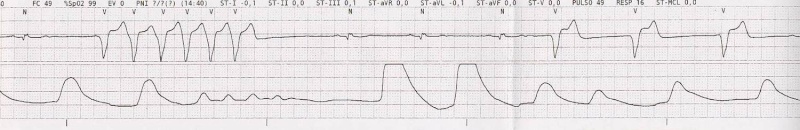 ecg0110.jpg